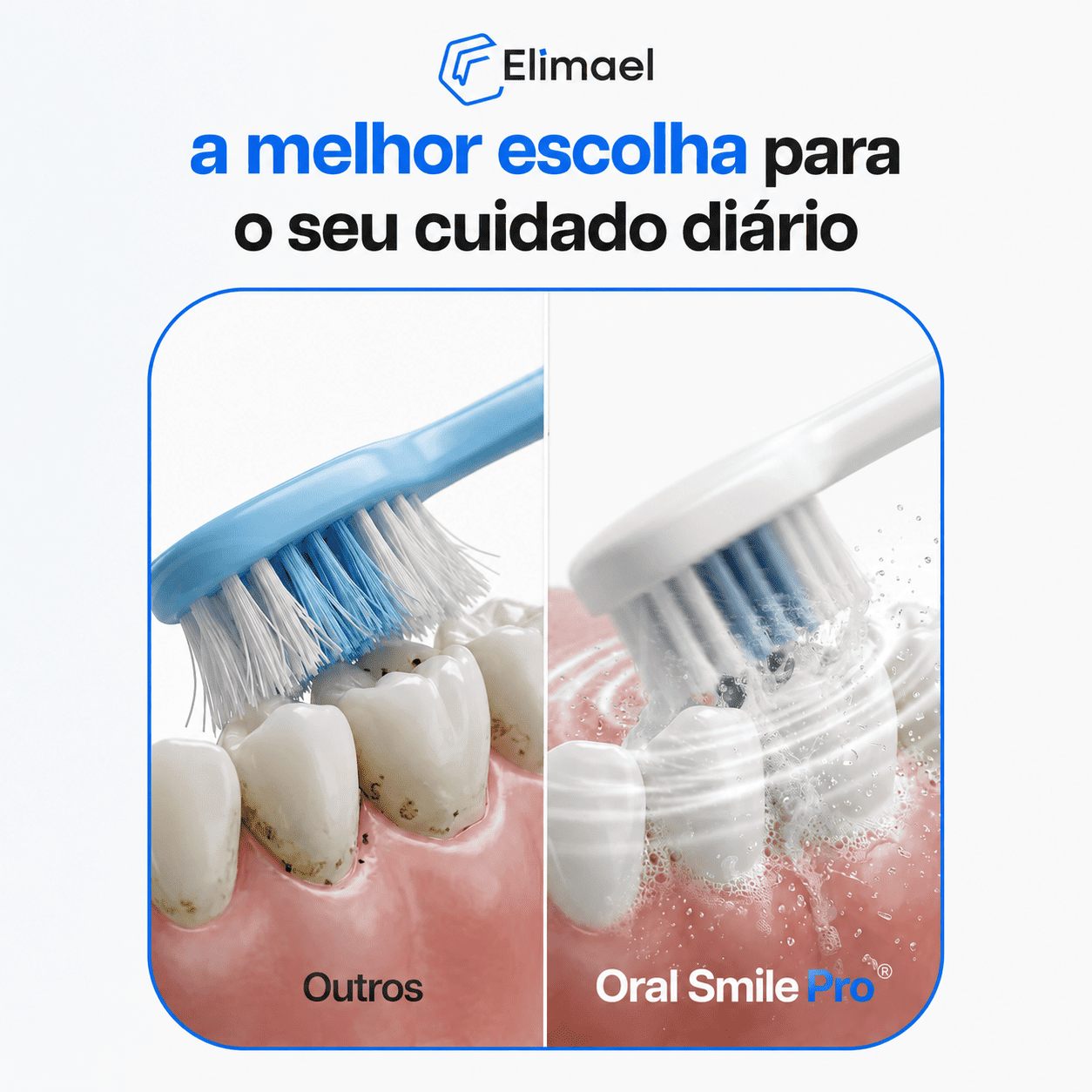 Escova de Dente Elétrica - OralSmile Pro®